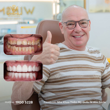 Slider image (4) WinSmile Dental Clinic Vietnam